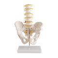 Pelvis dengan ukuran hidup dengan 5 pcs Vertebra Lumbar